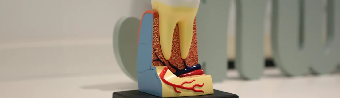 FC – Root Canal Treatment at Green Mountain Dental Group in Lakewood CO